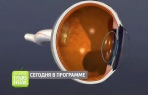 Как сохранить хорошее зрение