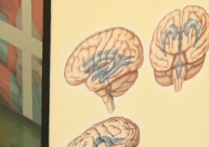 Опухоль головного мозга – симптомы